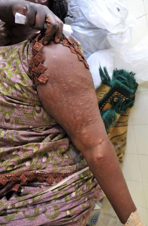 Women with Stretch Marks, Men With Dreadlocks stopped from Recruiting at Ghana Immigration Services – Reports